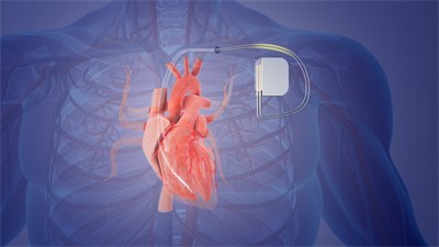 Illustration eines Defibrillators, Foto: Silver Place/istock.com