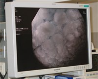 Detail eines Frottee-Tuches, gesehen durch das Endoskopiesystem. Foto: Funken