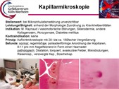 Erklärung Kapillarmikroskopie. Copyright: Dr. R. Horz