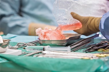 Organtransplantation, Foto: B. Petershagen